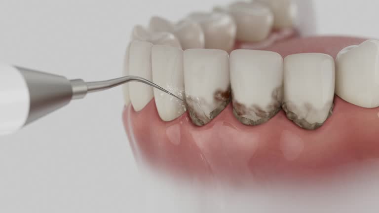 Trusted Dental Implants service in Davisboro, GA - Dentist Open Now
